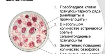 Миелоциты в крови при беременности