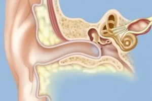 Сколько восстанавливается слух после отита