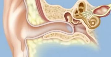 Сколько восстанавливается слух после отита