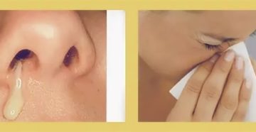 Почему гной воняет