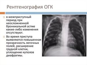 Рентген при бронхиальной астме