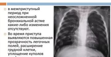 Рентген при бронхиальной астме