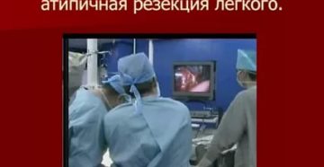 Атипичная резекция легкого