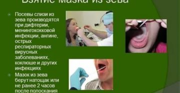 Взятие мазка из зева и носа алгоритм