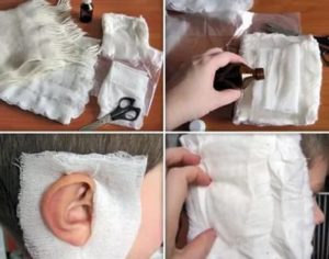 Как сделать водочный компресс ребенку