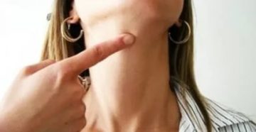 Болит под подбородком посередине