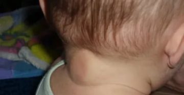 Ребенок чешет затылок и уши