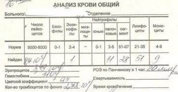 Анализ крови при ангине у ребенка