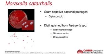 Branhamella catarrhalis в носу у ребенка Branhamella catarrhalis в носу у ребенка
