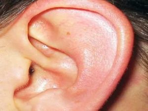 Горит внутри уха