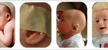 У ребенка разные уши причина У ребенка разные уши причина