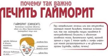Можно ли вылечить синусит без антибиотиков