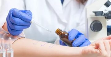 Как называется врач аллерголог