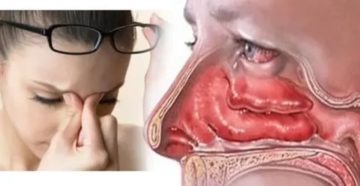 Почему ночью закладывает одну ноздрю