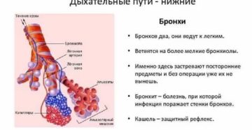 Бронхи это верхние или нижние дыхательные пути