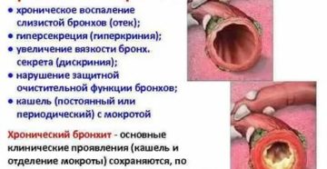 Отек бронхов симптомы и лечение