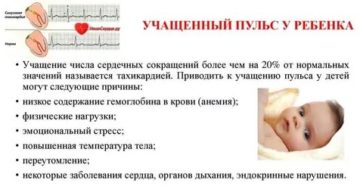 Учащенное сердцебиение у ребенка при температуре