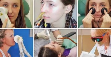 Физиопроцедуры при рините