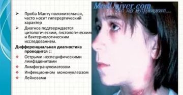 Какие лимфоузлы увеличиваются при туберкулезе
