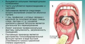 Сколько дней лечится ларингит