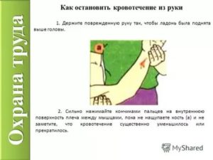 Как остановить кровь из головы