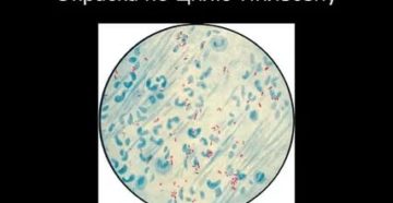 Циль нильсен окраска