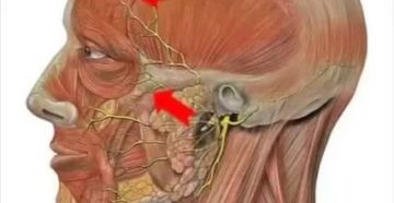 Застудил тройничный нерв что делать