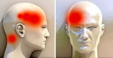 Болит лоб при надавливании