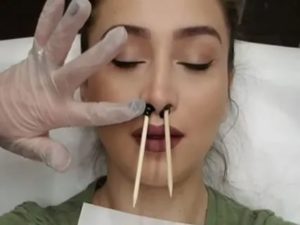 Волосы в носу у девушек как избавиться