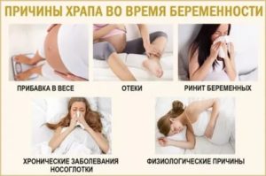 Храп во время беременности причины
