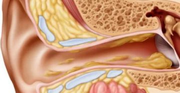 От чего образуется сера в ушах