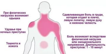 Ощущение холода в области сердца