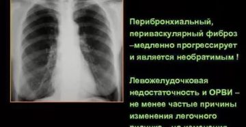 Периваскулярные изменения в легких