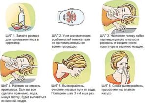 Что делать чтобы насморк быстрее прошел