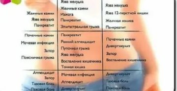 Почему когда кашляешь болит низ живота