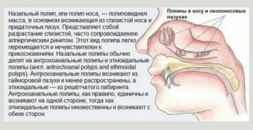 Щелкает в носу причины