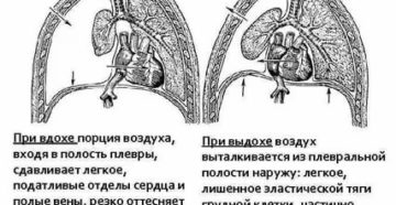 Боль в области сердца при глубоком вдохе