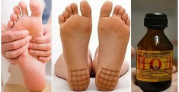 Йодная сетка на пятки