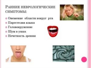 Немеет рот причины